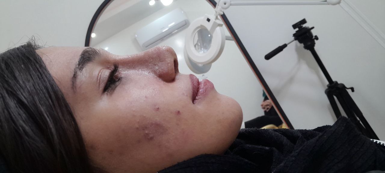 نمونه عمل های دکتر اردشیر کشاورز