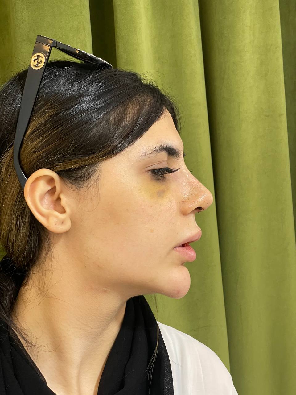 نمونه عمل های دکتر اردشیر کشاورز
