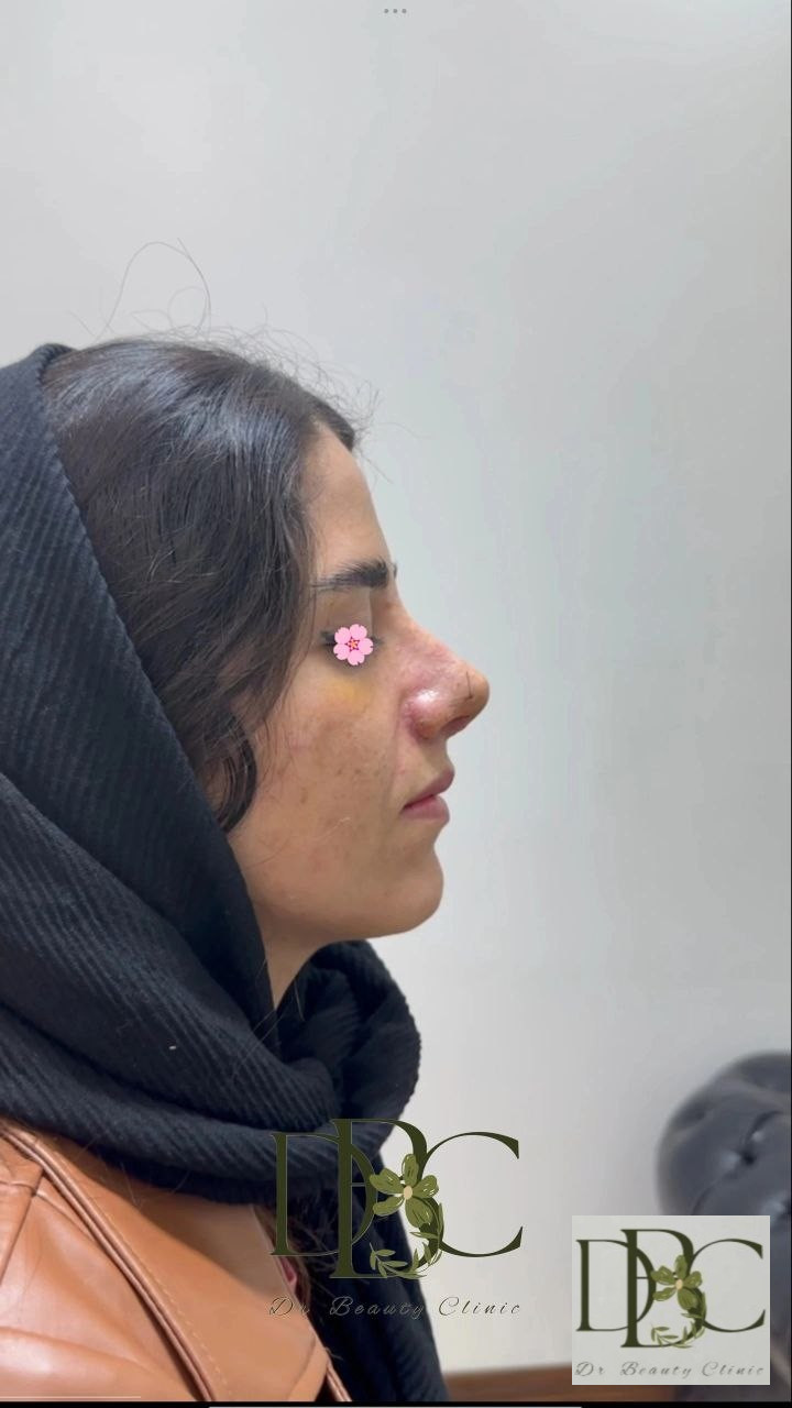 نمونه عمل های دکتر کشاورز