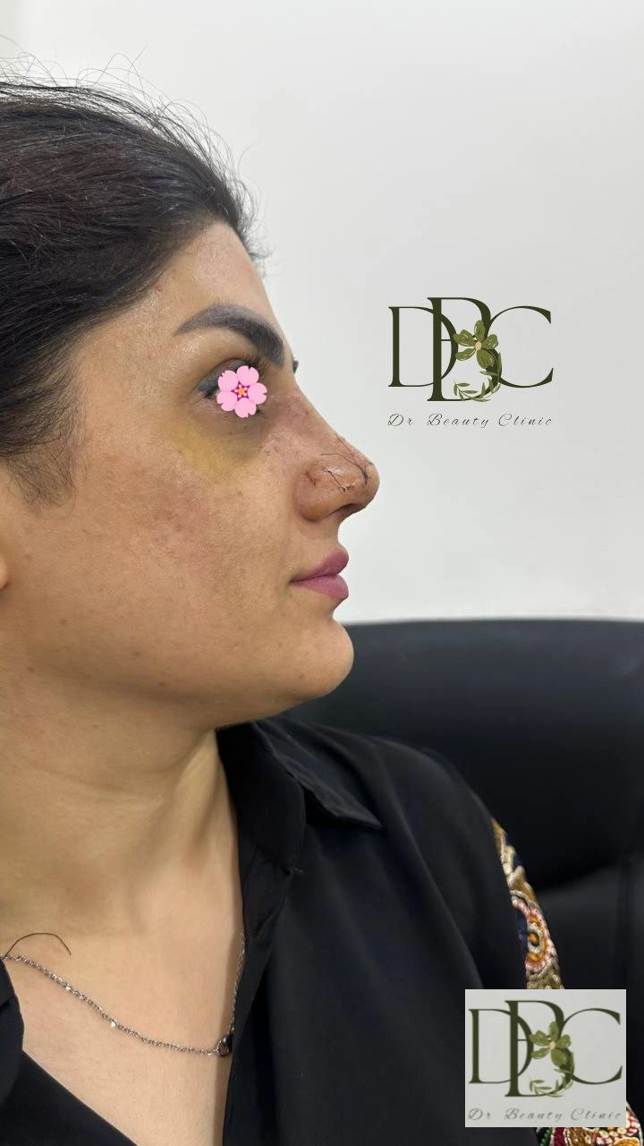 نمونه عمل های دکتر کشاورز