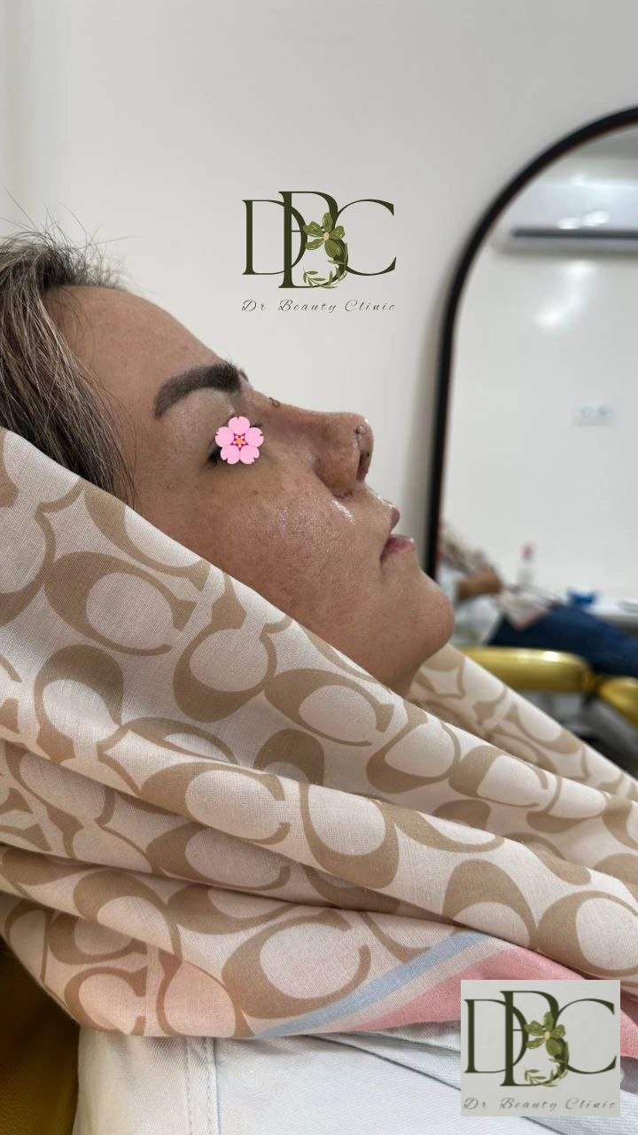 نمونه عمل های دکتر کشاورز